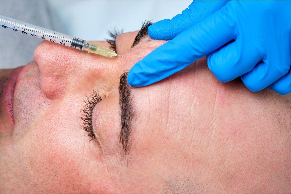 injecting botulinum between the eyebrows